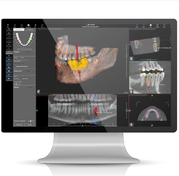 de Gotzen - Xgenus Aries Panoramic Ceph Imaging System - Standing